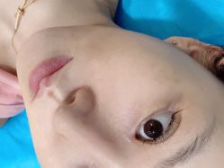 体验后-南京康美美容医院·旗舰店