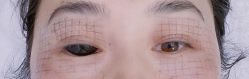 -北京楚诺医疗美容