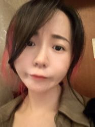 体验后-广州美莱医疗美容医院