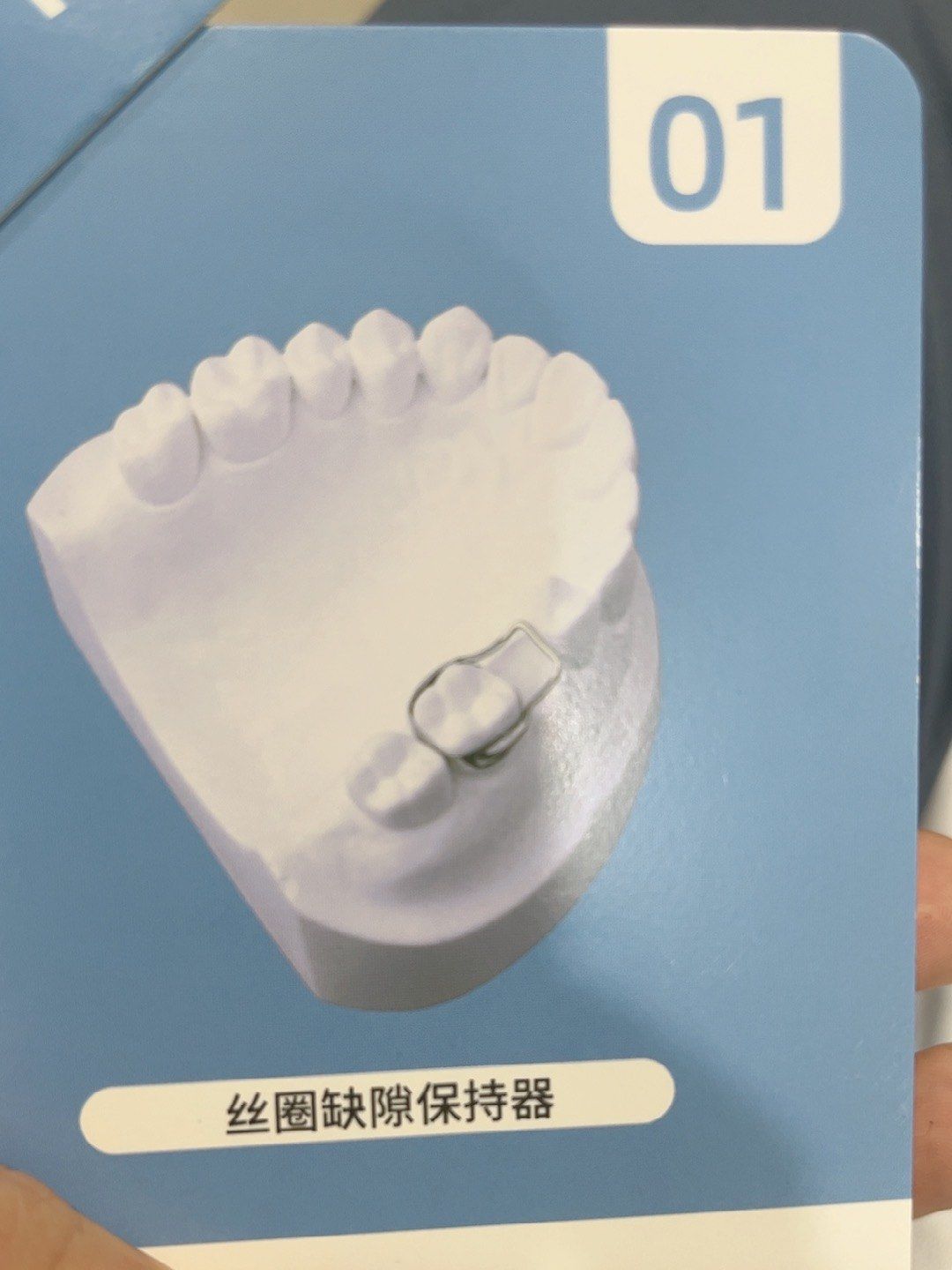 间隙保持器一般用于,乳牙因为蛀牙过早脱落