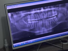 -土豆口腔(凤凰北总店)