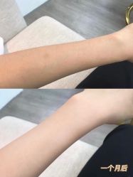 -慕颜医疗美容·皮肤微整 抗衰