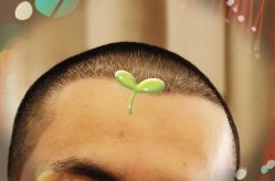 -大麦微针植发全国连锁