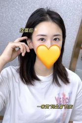 点击看大图 -OnFaer.纹眉半永久无创洗眉
