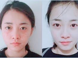 -SKINIST丽铂医疗美容