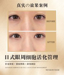 -POCO宝珂丽科技美肤