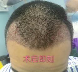 体验后-厦门美莱整形美容医院