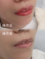 -西施无菌半永久纹绣眉眼影唇轻增发纹发际线
