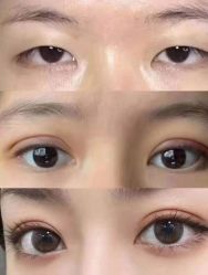 -上海漾颜医疗美容