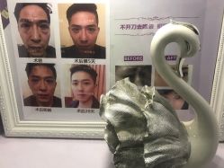 -天津健丽·去眼袋医疗美容机构