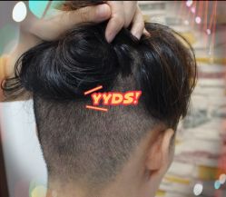 -大麦微针植发全国连锁