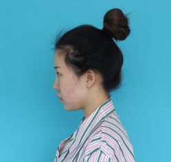 点击看大图 体验前-鑫元辰医疗美容整形