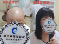 -唐风采假发补发定制