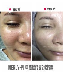 -MLP美丽派·问题肌疗愈中心
