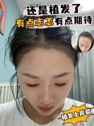 点击看大图 -雍禾植发全国连锁