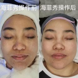 -安吉拉青春化管理中心