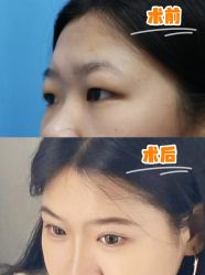 -深圳艺星医疗美容医院