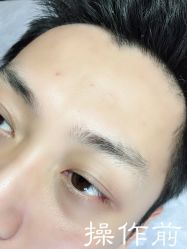 点击看大图 -西施无菌半永久纹绣眉眼影唇轻增发纹发际线