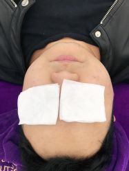 -蕾特恩专业祛痘国际连锁