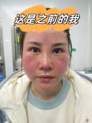 -素美医疗美容·西南眼鼻整形·修复基地
