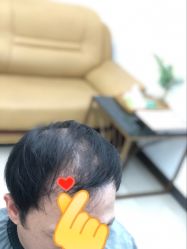 -发饰美男士增发补发假发定制店