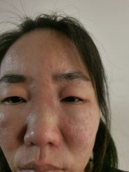 -安徽合肥韩美整形外科医院