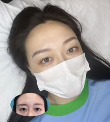 -杨益美学·野生眉半永久纹眉发际线