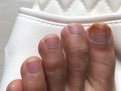 -世龙世家甲沟炎·灰指甲·嵌甲矫正·修脚(武侯区双楠店)