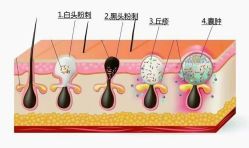 -安吉拉青春化管理中心