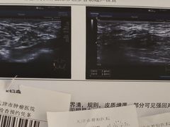 -天津医科大学肿瘤医院(本部院区)