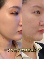 -大华韩艺整形美容医院