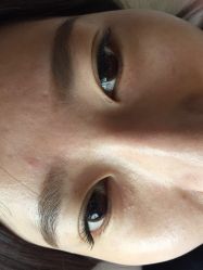 -美丽人生祛斑扁平疣汗管瘤中心
