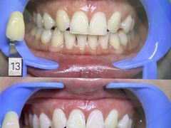 -极光口腔·矫正种植修复(锦江院区)