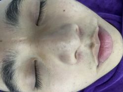 -蕾特恩专业祛痘国际连锁
