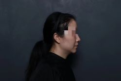 -BR光电保养