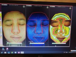 点击看大图 皮肤诊断-光SPA科技美肤