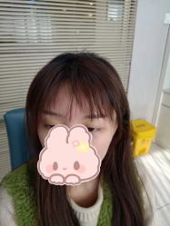-大麦微针植发丨全国连锁