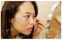 -广州健丽·去眼袋医疗美容机构