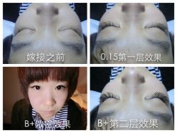 点击看大图 iphone_upload_pic-光SPA科技美肤