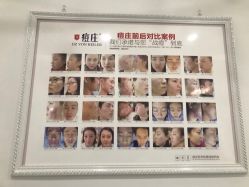 -痘庄·科学祛痘领跑品牌