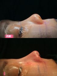 -北京米扬丽格医疗美容·联合丽格鼻整形中心