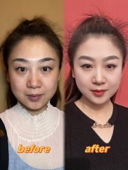 -天津健丽·去眼袋医疗美容机构