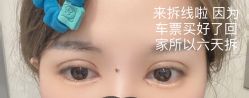 -上海时光整形外科医院