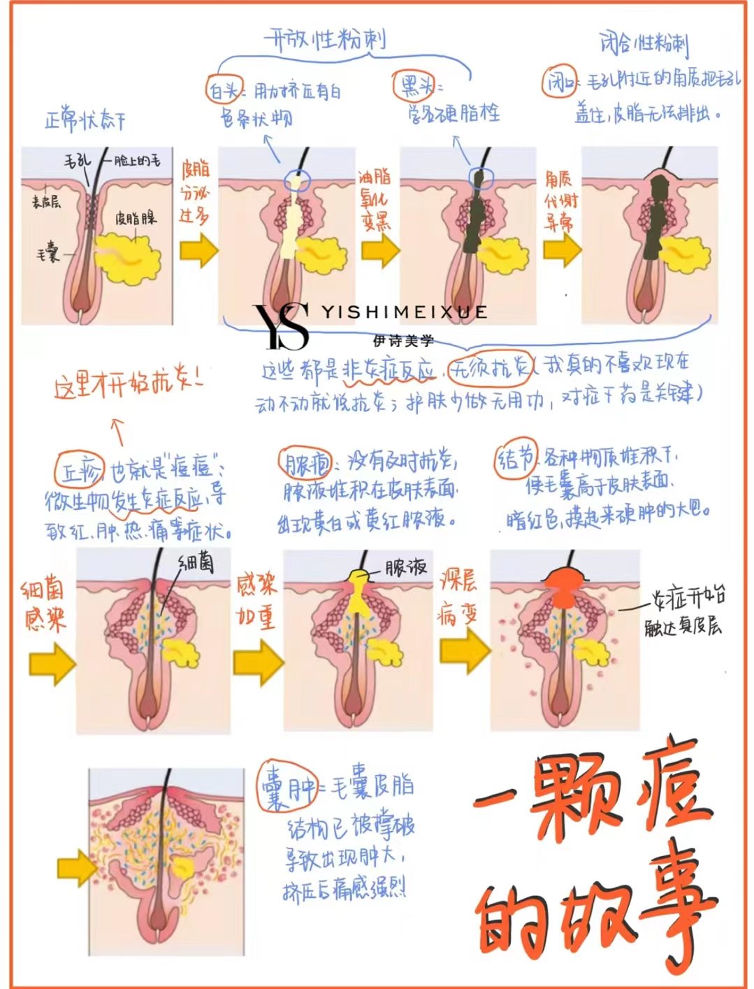 为什么长粉刺图片