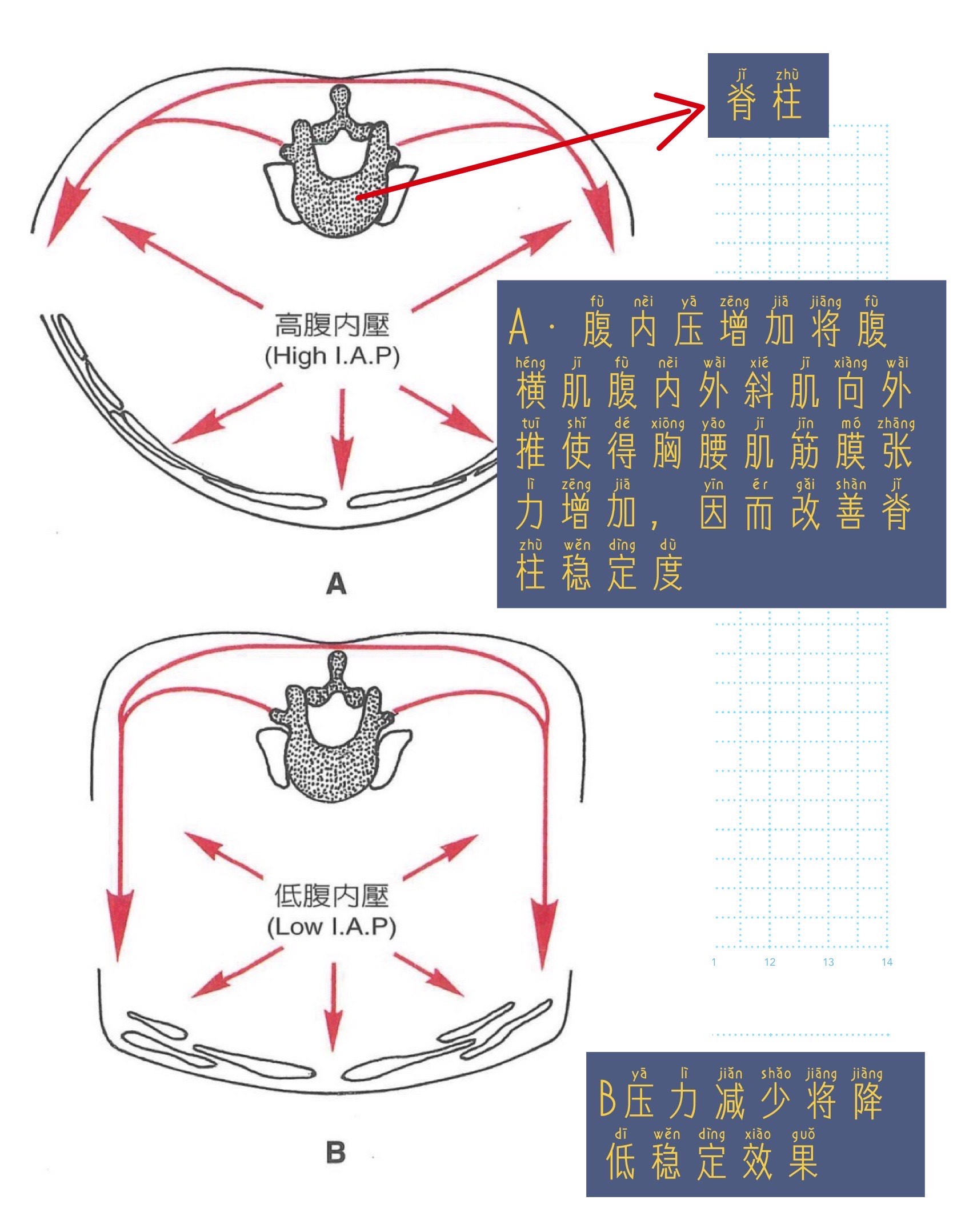 简易腹内压测量图片图片