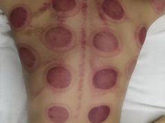-SPA·印象足道养生(大运河度假区四望亭店)