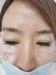 -More摩尔医美の注射线雕光电中心