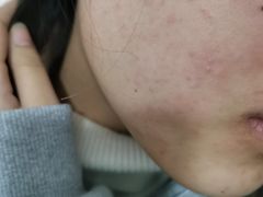 -中国医学科学院皮肤病医院