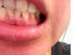 -微笑牙科口腔(三亚迎宾院区)