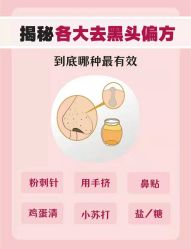 -蕾特恩·专业祛痘国际连锁
